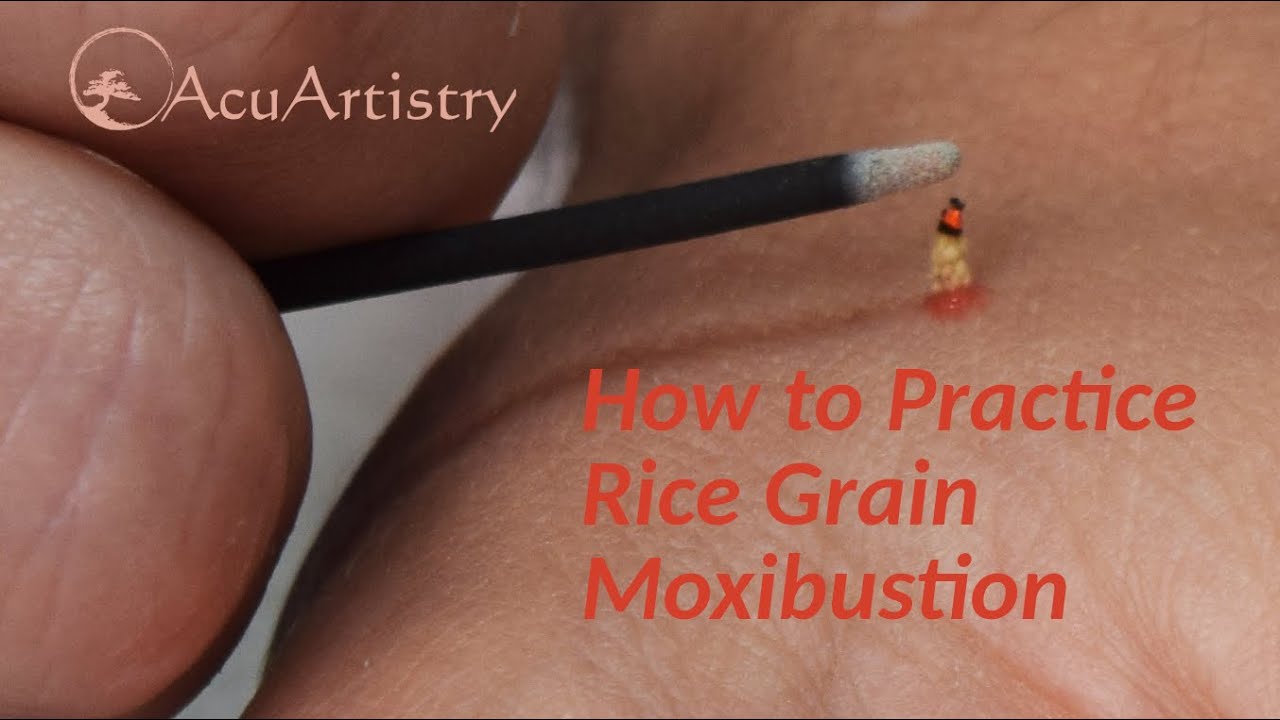 Basic Direct Moxibustion Technique; Okyu