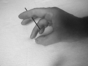 Moxibustion rolling technique, removing the floss