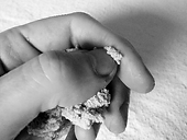 Moxibustion rolling technique, rolling the floss