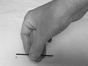 Moxibustion rolling technique, lighting the floss